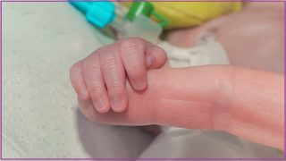 AI breakthrough in premature baby care 