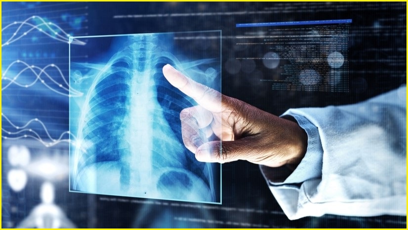 Doctor's finger pointing at a chest x-ray.