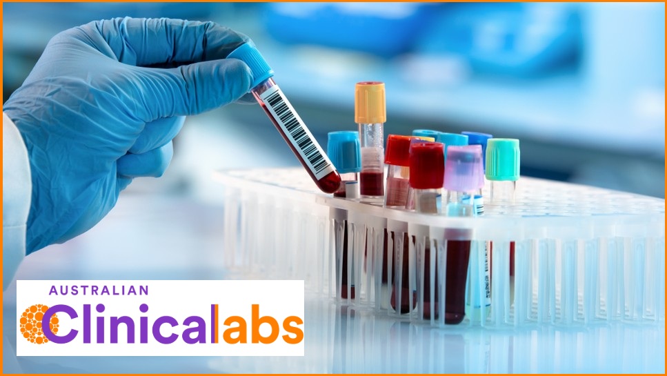 A tray of test tubes containing blood samples.