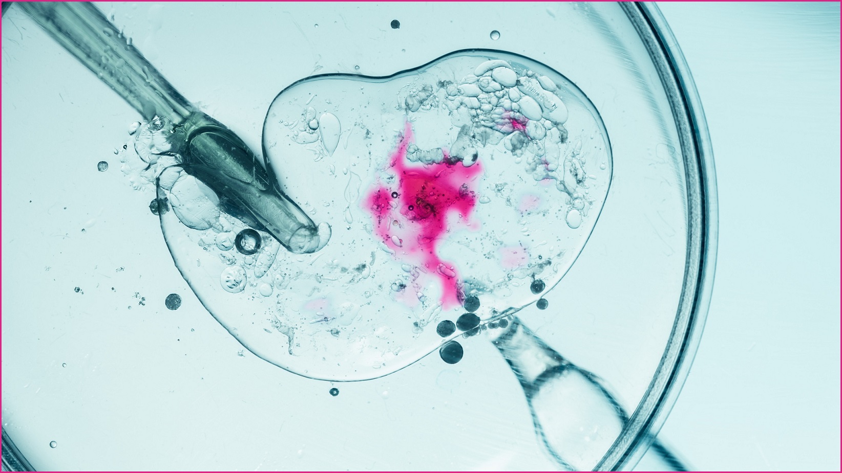 IVF under the microscope