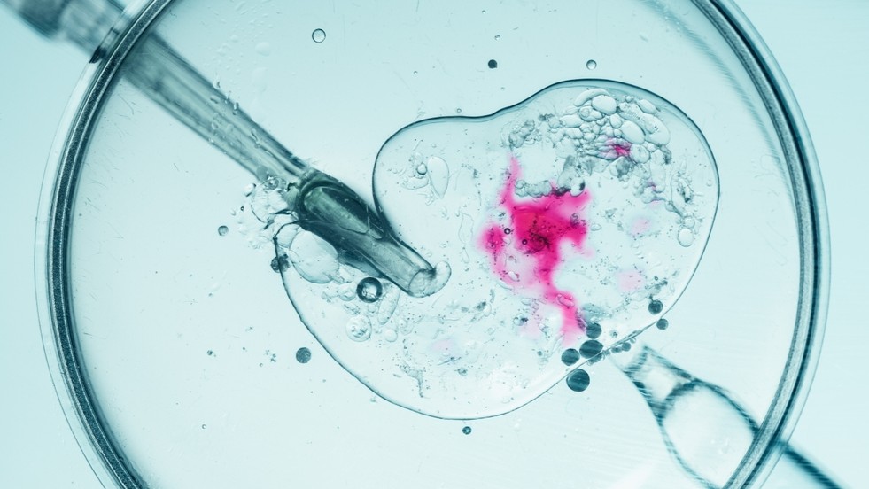IVF dish
