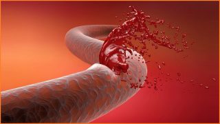 NBN is bleeding fixed-line customers